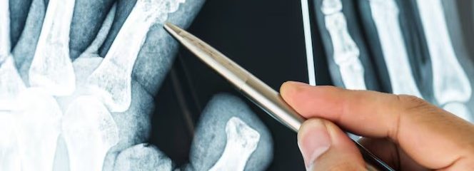 Approche orthopédique à Chavannes